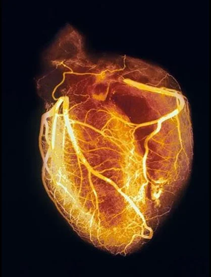 Re-Stenting