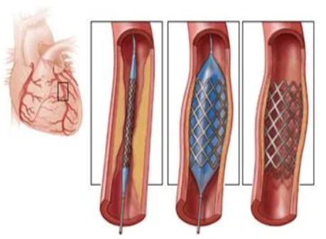 Diagnosis and Treatment