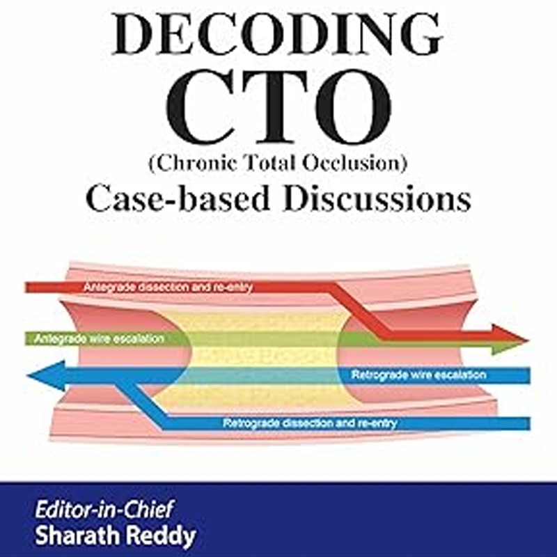 CTO Interventions book cover